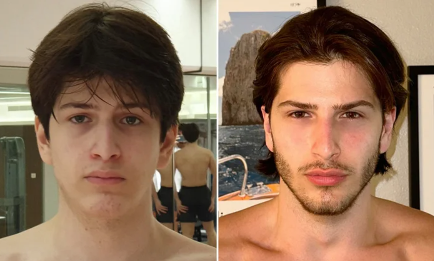 Young man with casual appearance before glow-up transformation